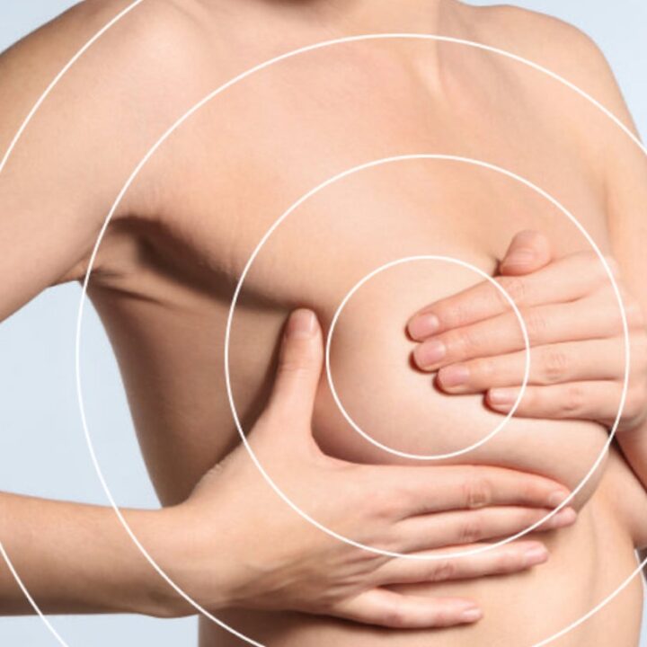 Treating Breast Lumps