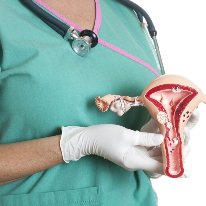 Endometrial Hyperplasia