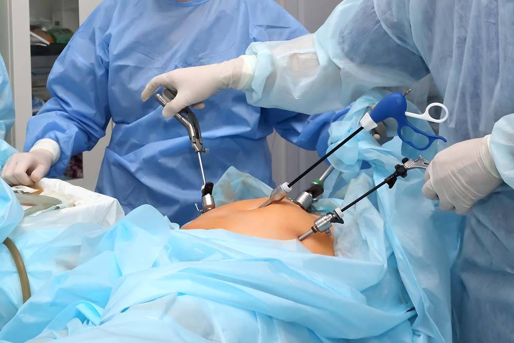 Best Laparoscopic surgeon in Dhanori