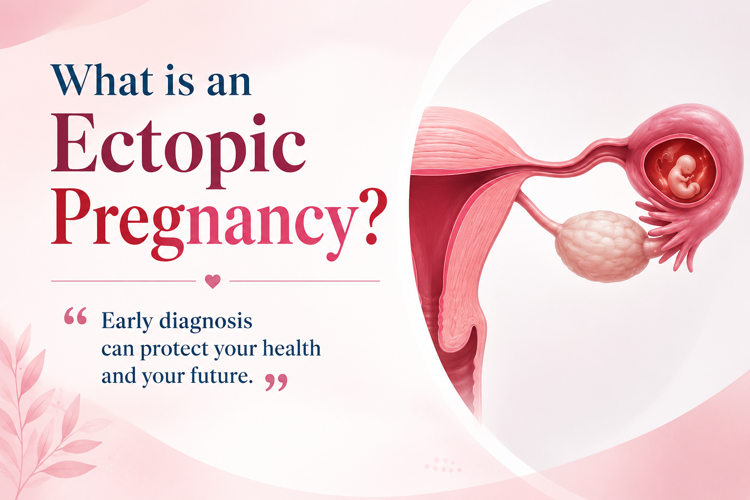 What is an Ectopic Pregnancy? Signs Every Woman Should Know